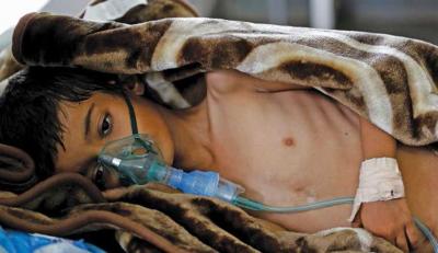 "يونيسف" تناشد العالم: 55 ألف حالة إصابة محتملة بالكوليرا في اليمن 