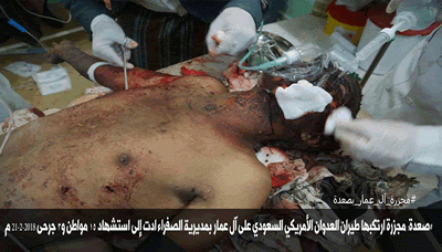 استشهاد وإصابة 18 مواطنا بغارة استهدفت سيارات بمديرية الصفراء بصعدة
