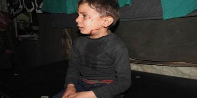 إصابة 5 مدنيين جراء اعتداءات إرهابية على أحياء سكنية في دمشق ودرعا وبلدتي كفريا والفوعا (محدث)