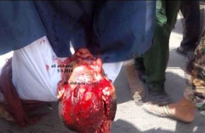 منظمة يمن تدين المجزرة الوحشية التي  ارتكبها قوات الأمن ضد المتظاهرين امام رئاسة الوزراء بصنعاء